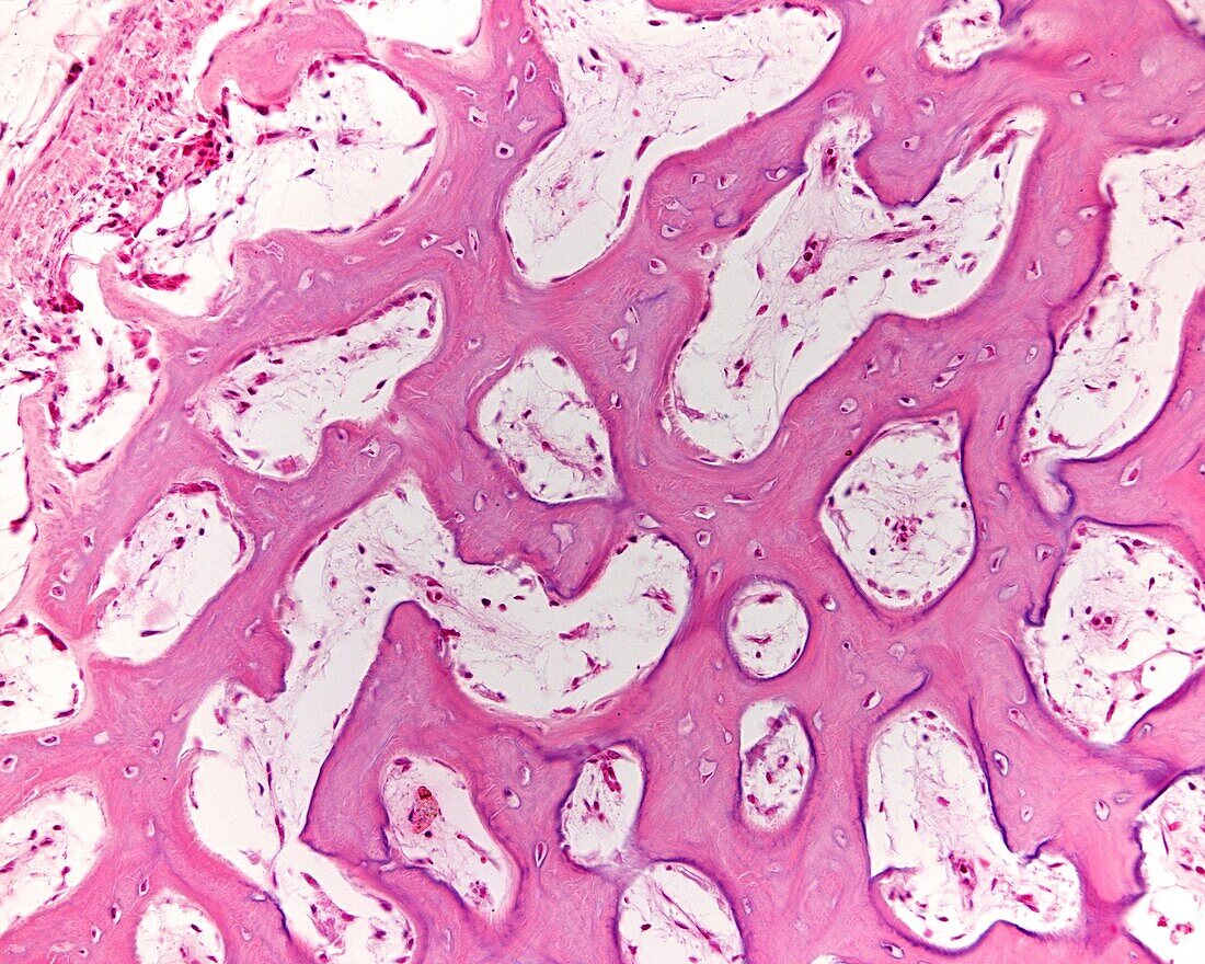 Intramembranous ossification, light micrograph