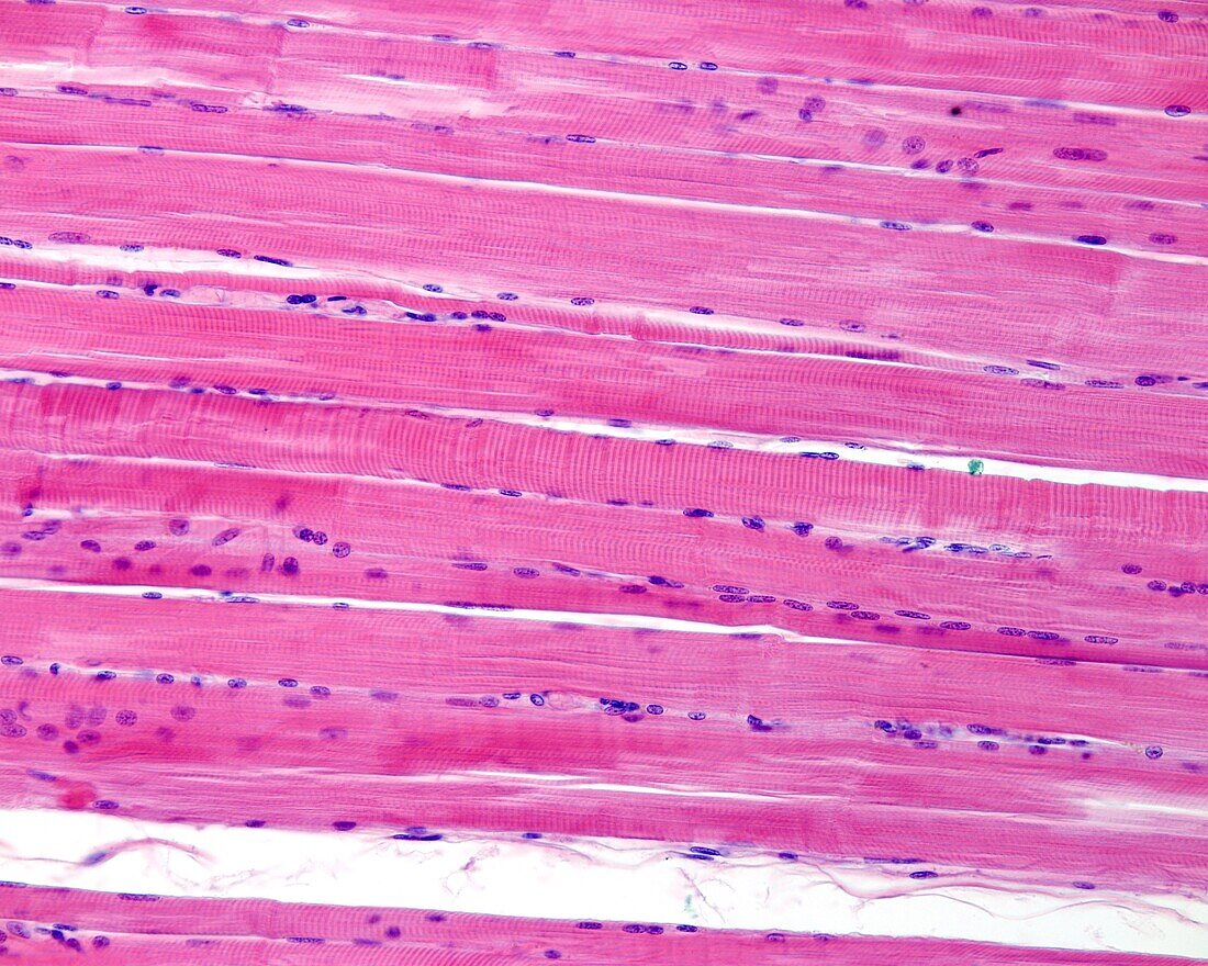 Striated muscle fibres, light micrograph