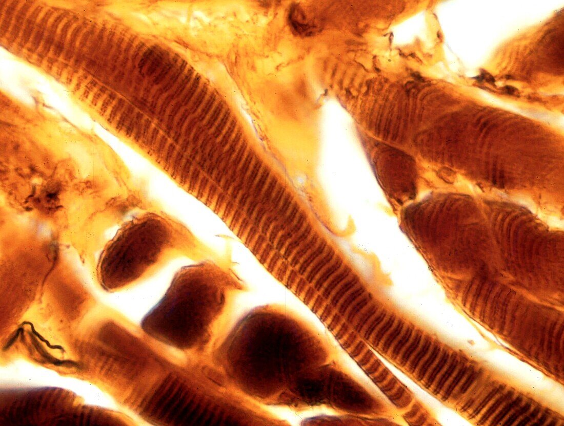 Skeletal muscle fibres, light micrograph