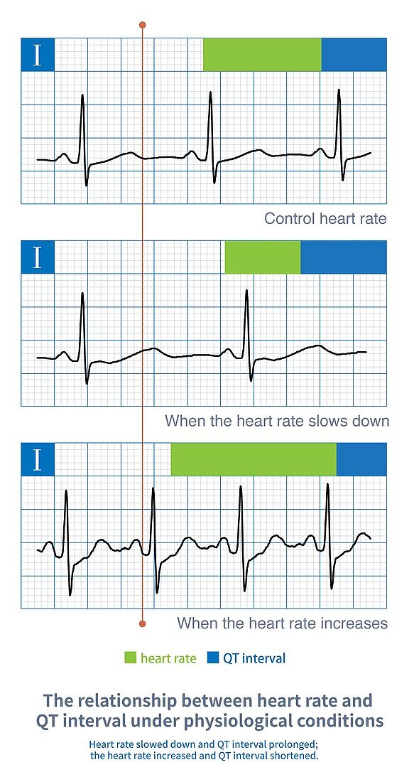 Heart rate and QT interval relationship, illustration