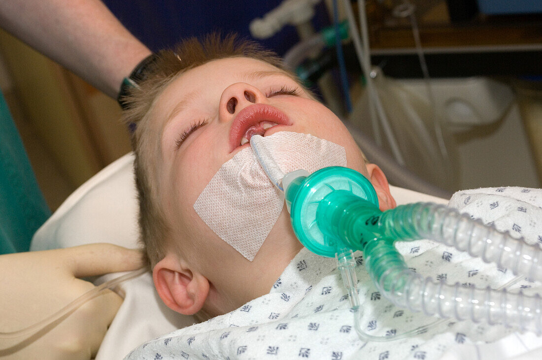 Child intubated during surgery