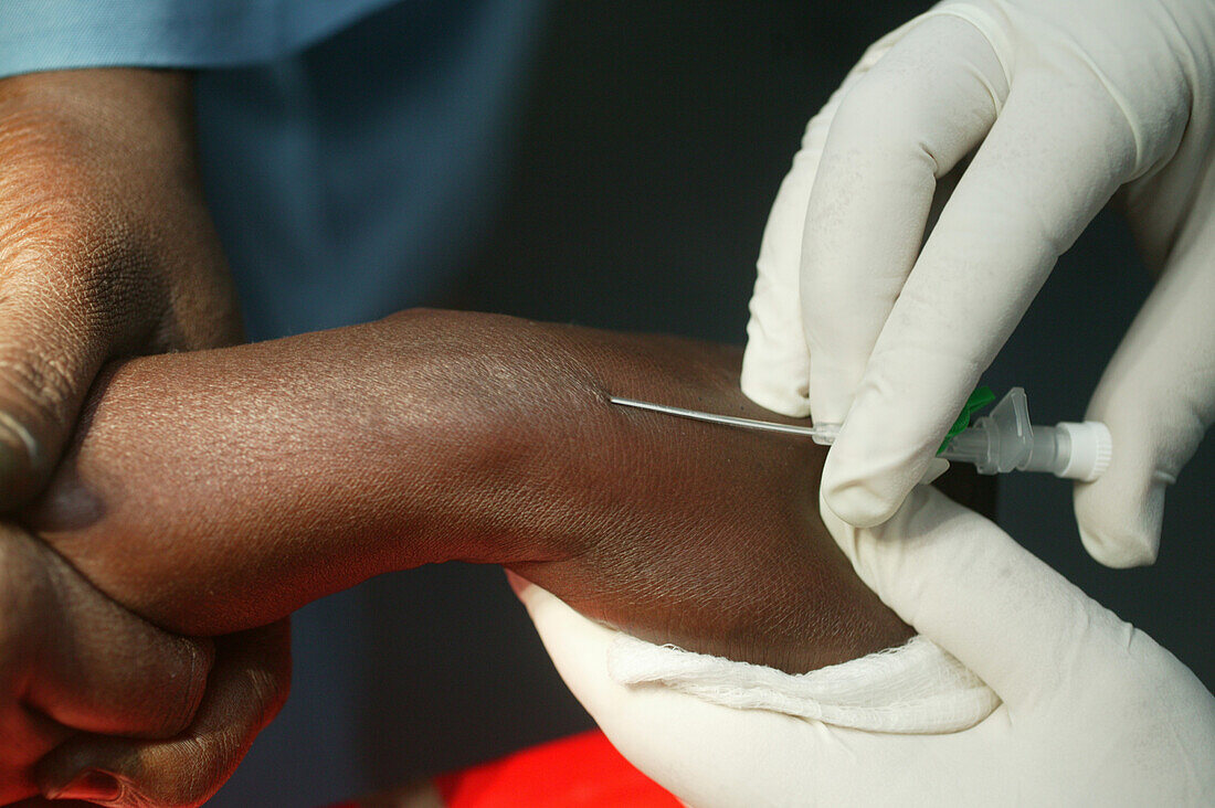 Administering drugs through a cannula