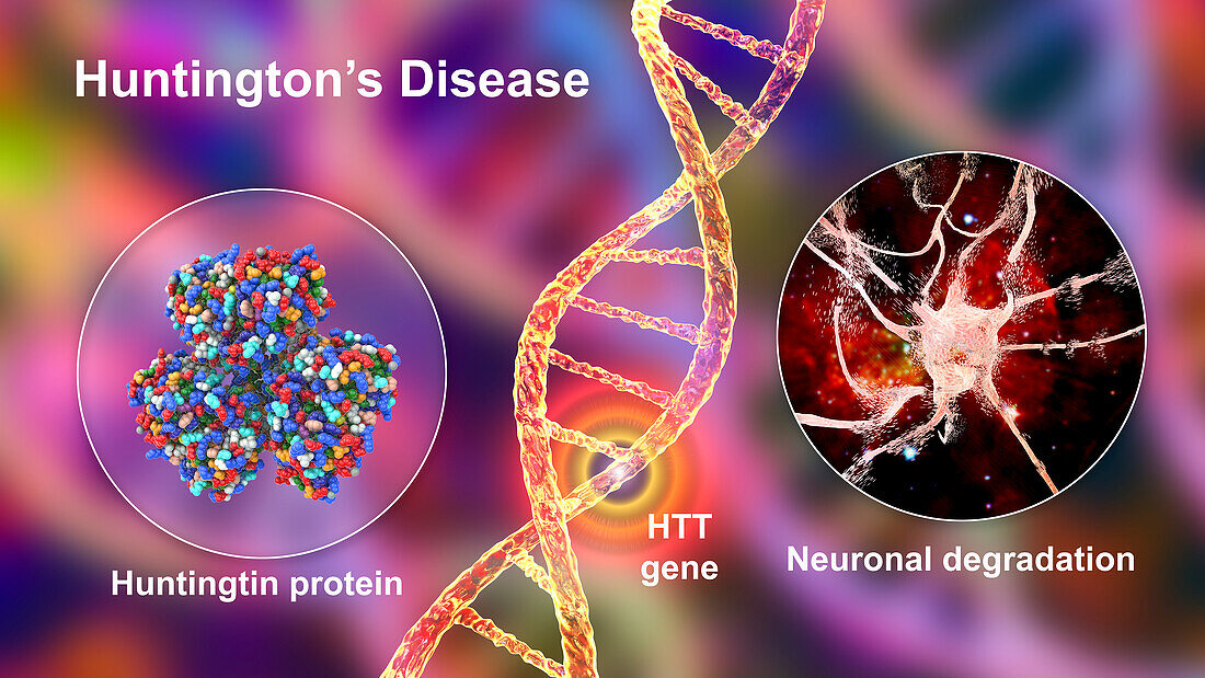 Huntington's disease, conceptual illustration