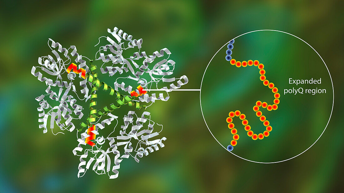Mutant Huntingtin protein, illustration