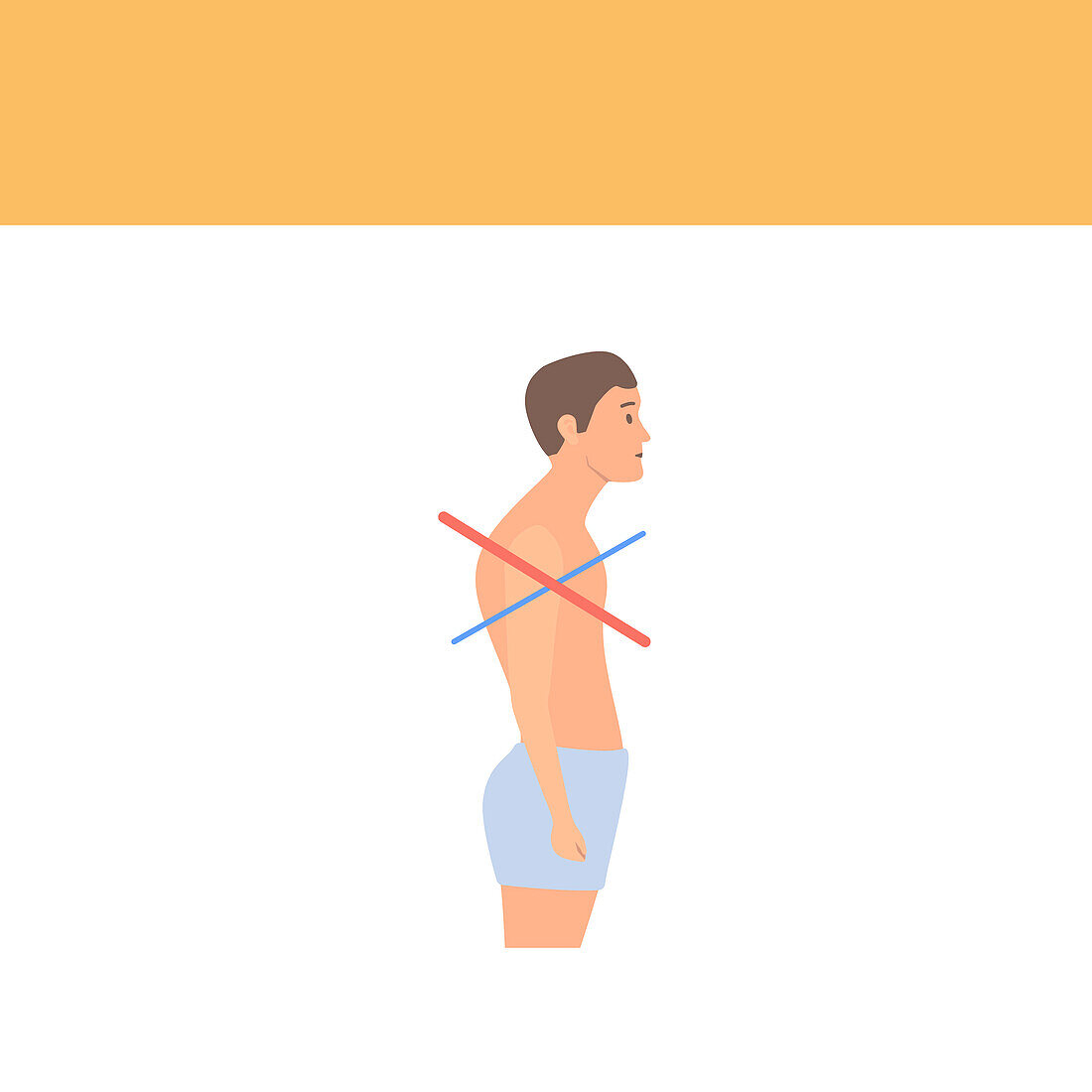 Upper crossed syndrome, conceptual illustration