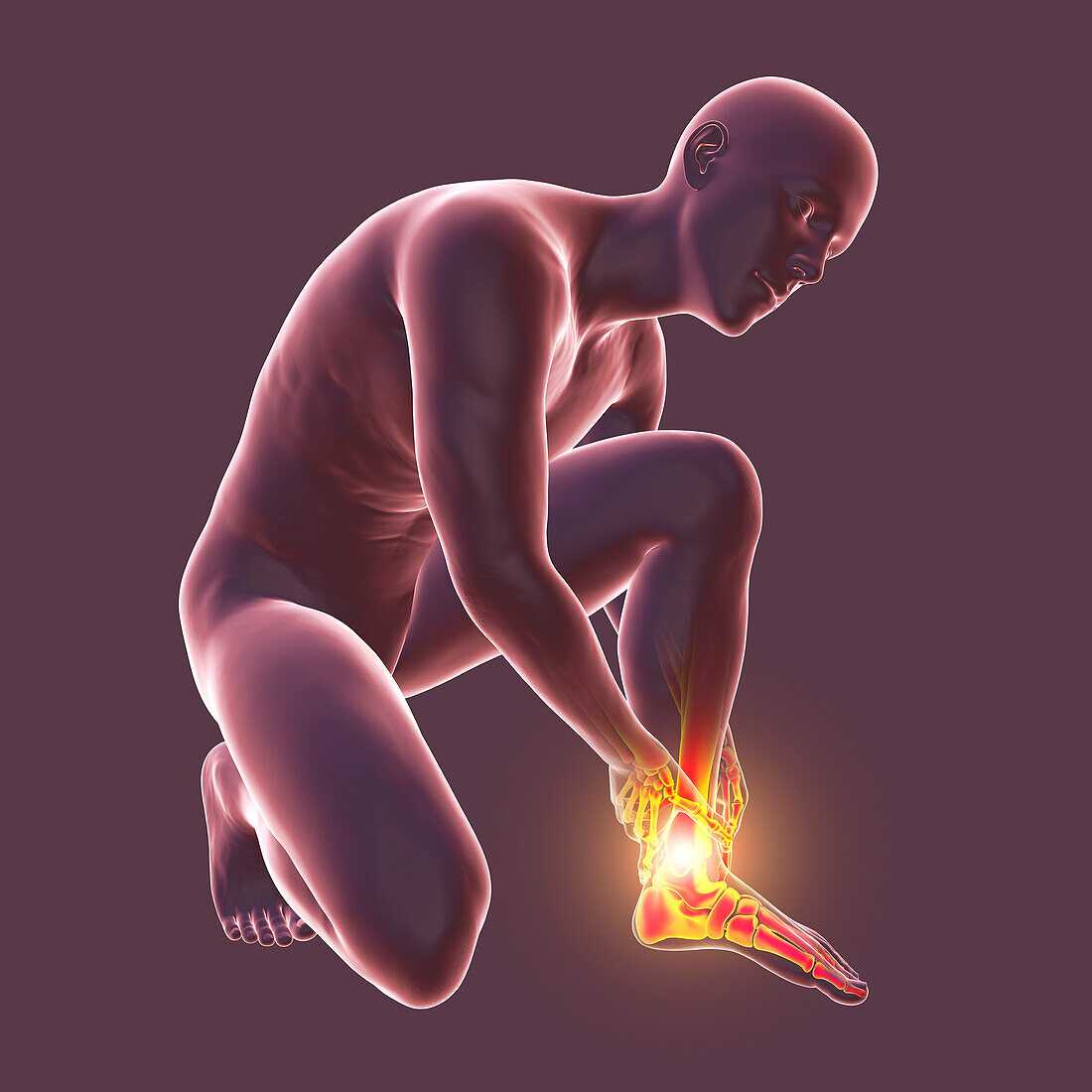 Painful ankle, illustration
