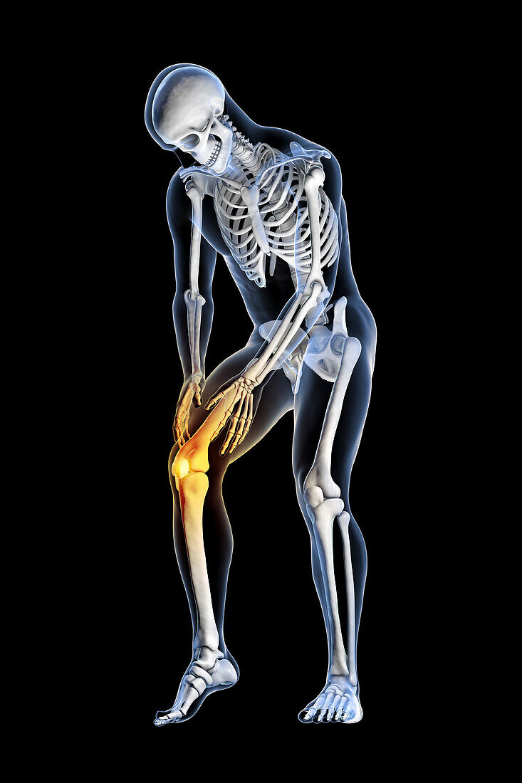 Human knee pain, illustration