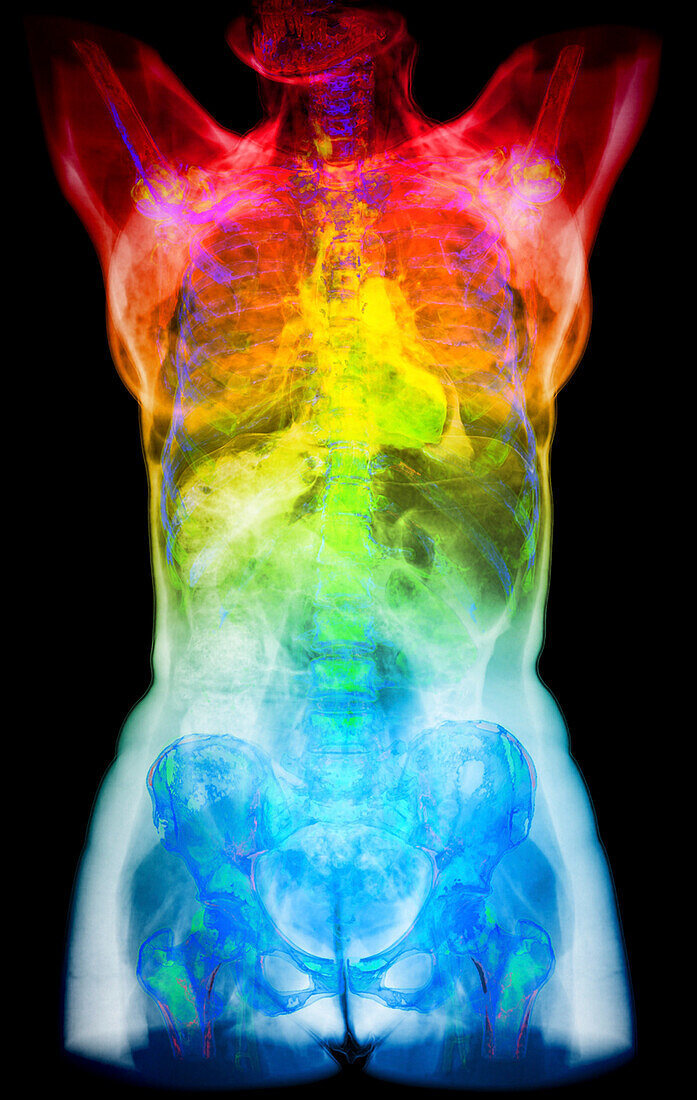 Human torso, coloured CT scan