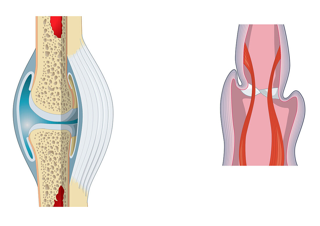 Joints, illustration