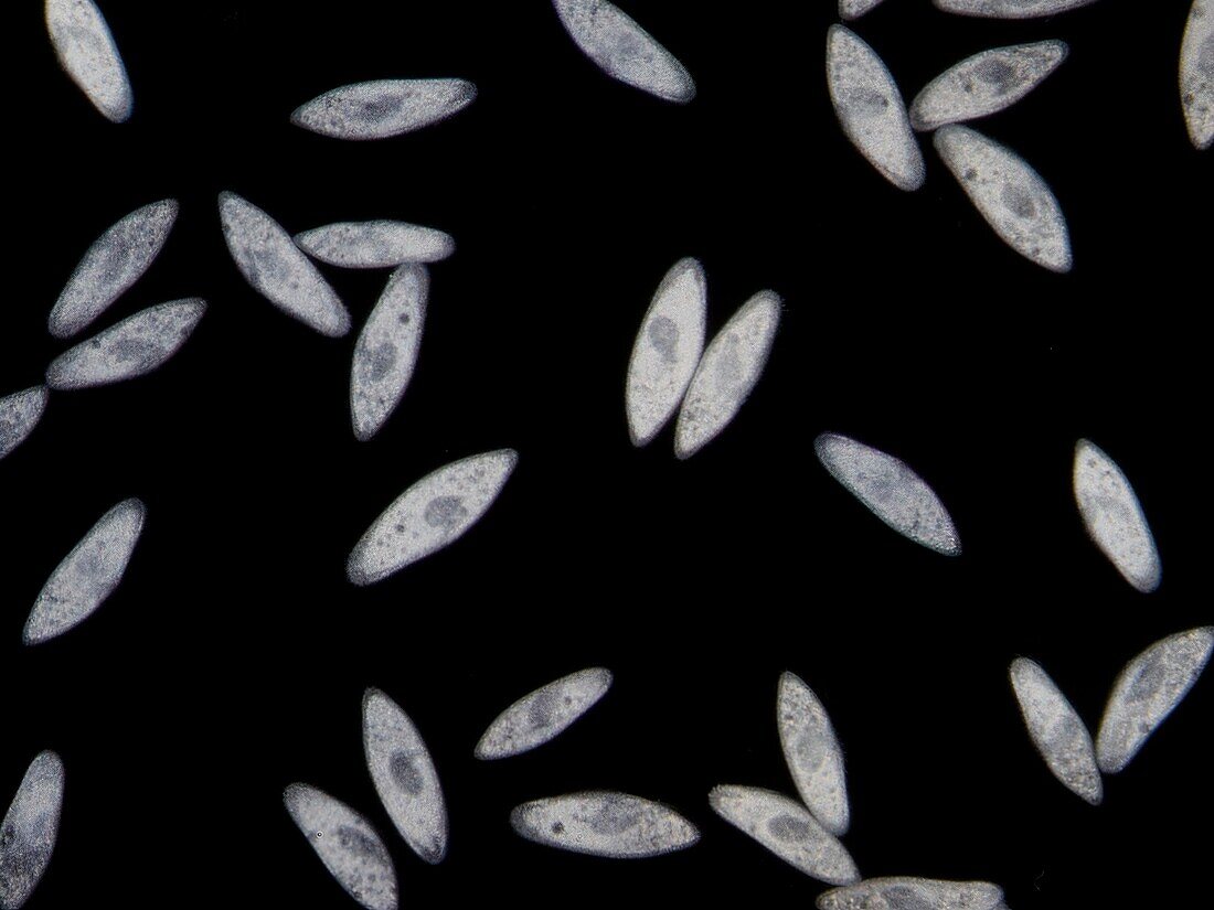 Paramecium caudatum group, light micrograph