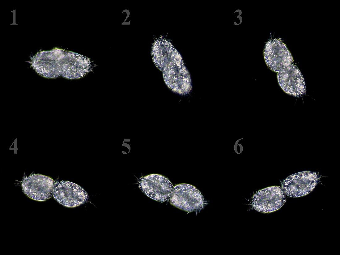 Oxytricha protozoa reproducing by fission, light micrograph