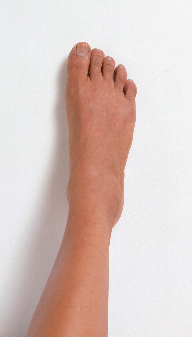 Girl's foot