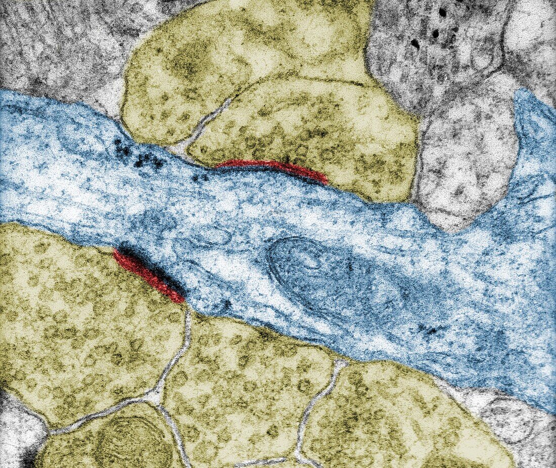 Axodendritic synapses, TEM