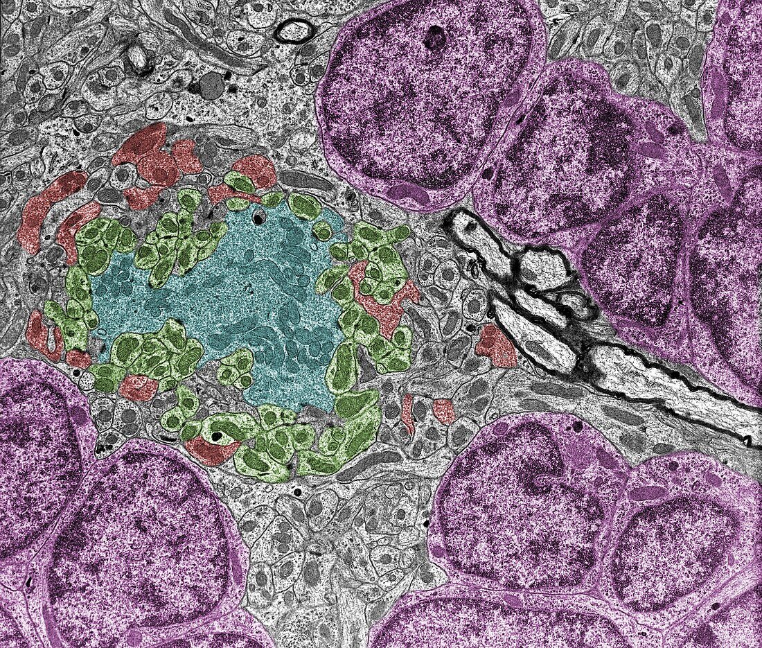 Cerebellar glomerulus, TEM