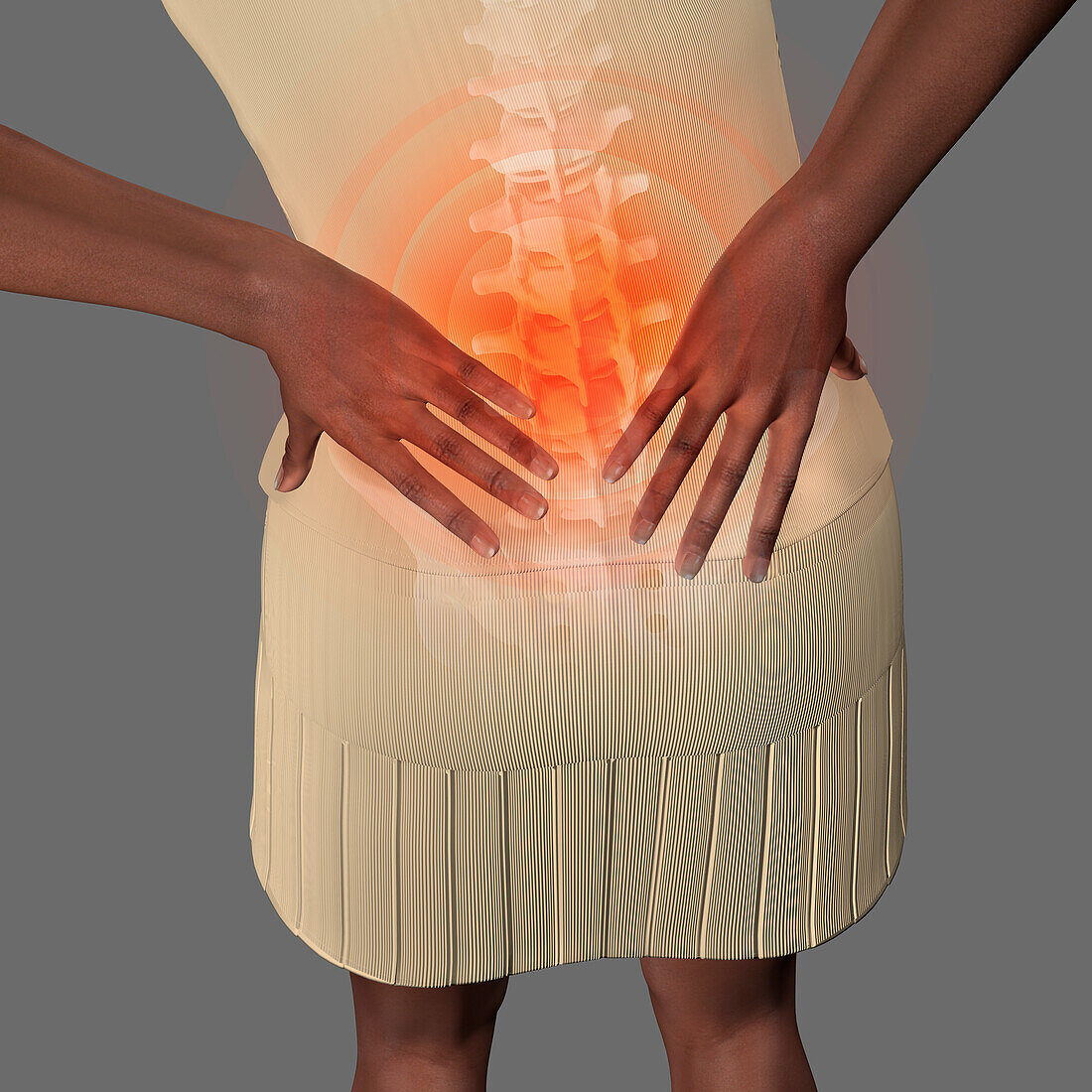 Lower back pain, illustration