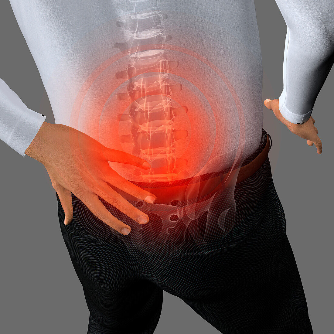 Lower back pain, illustration