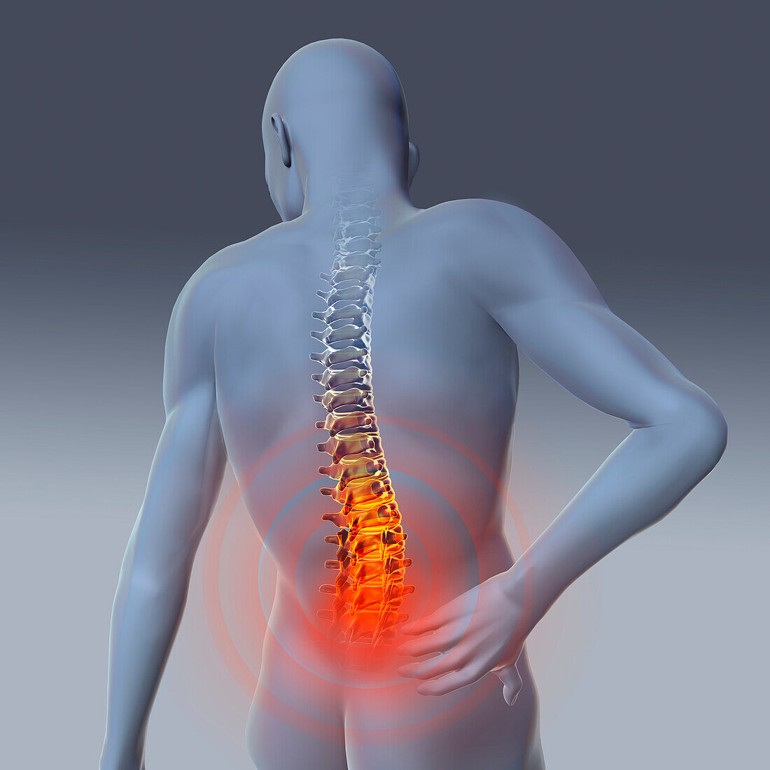 Lower back pain, illustration
