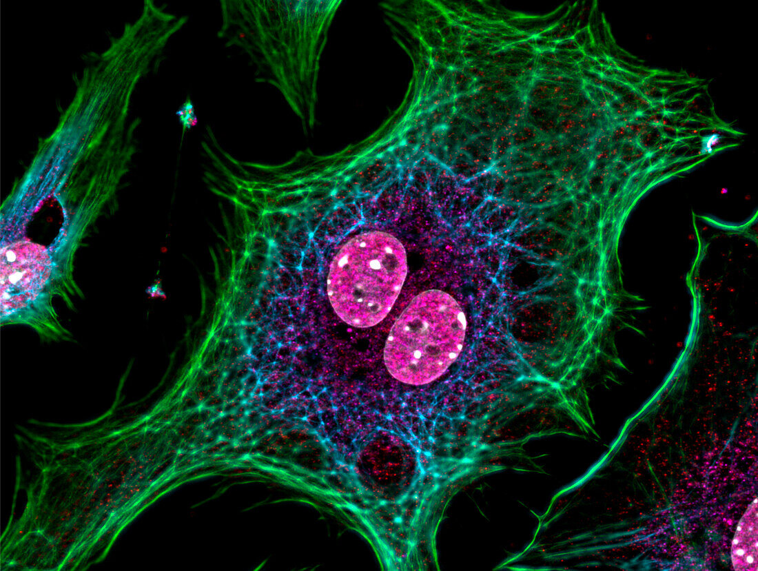 Fibroblasts, fluorescent micrograph