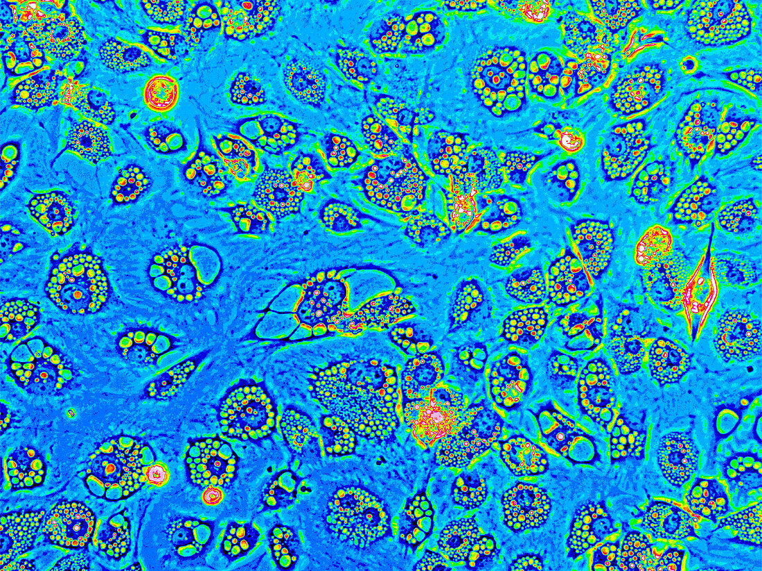 Fibroblast heatmap, light micrograph