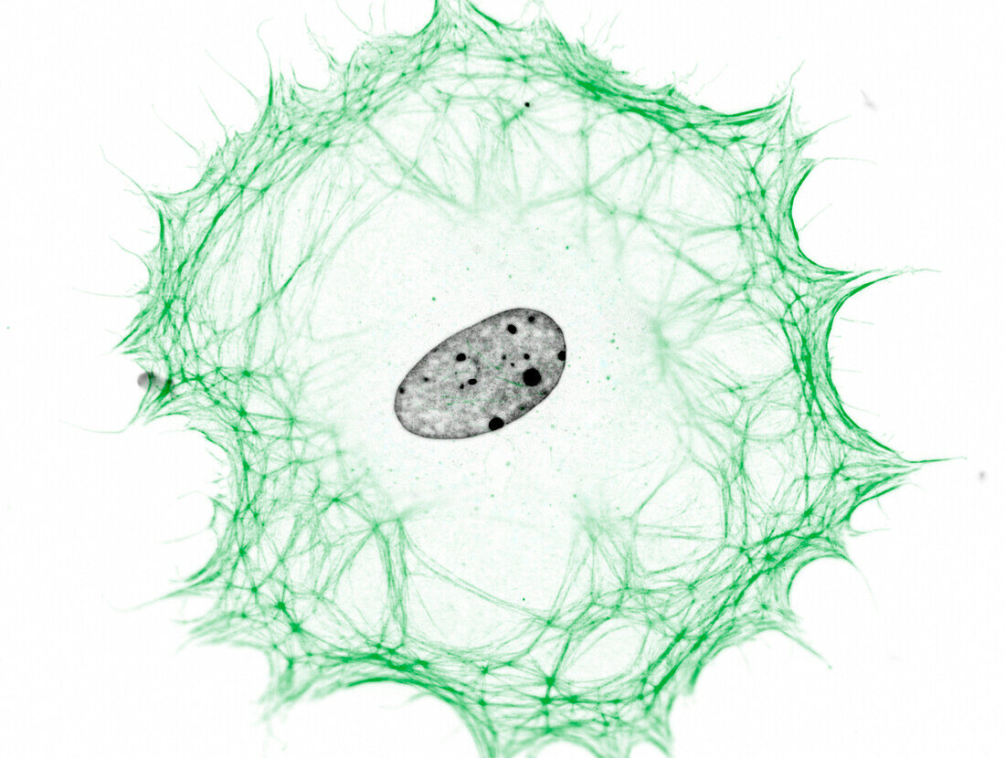 Fibroblast, fluorescent micrograph