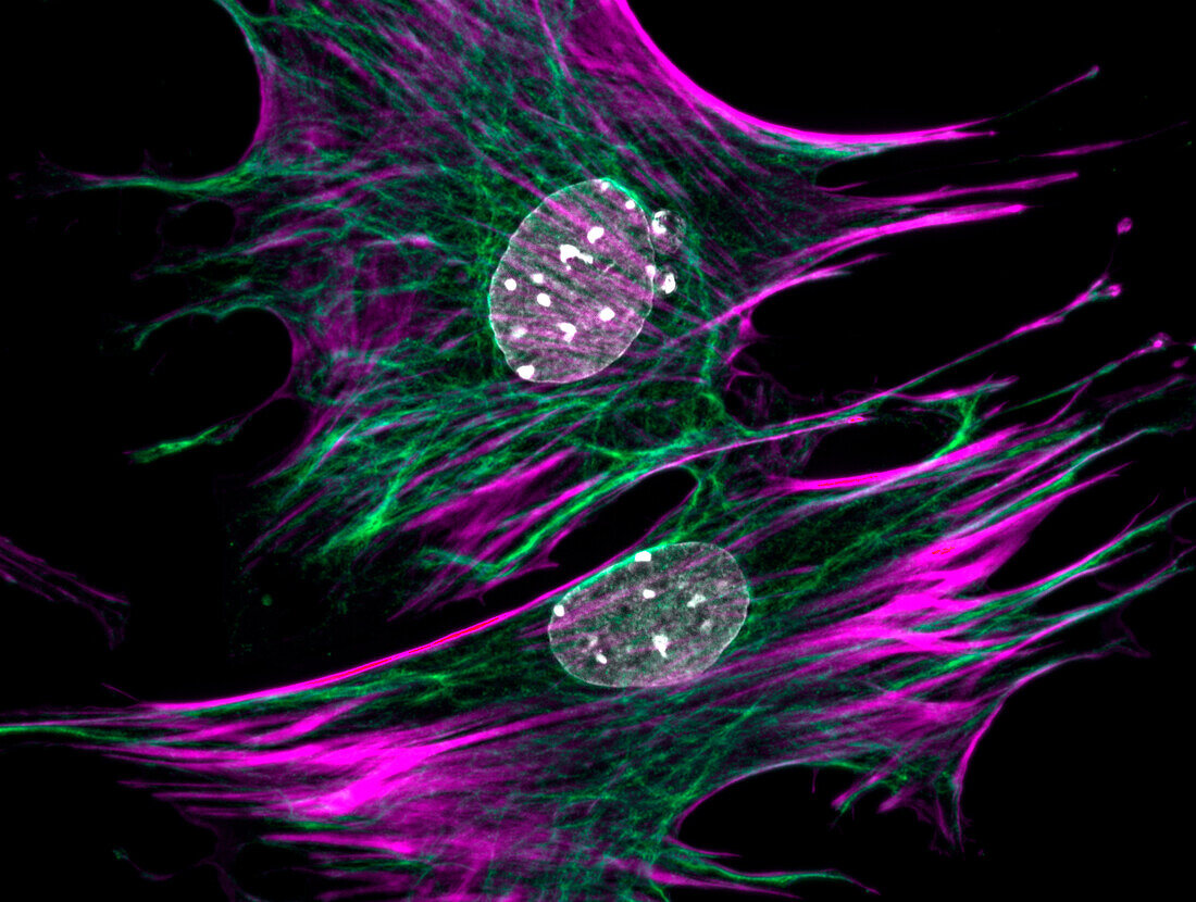 Fibroblasts, fluorescent micrograph