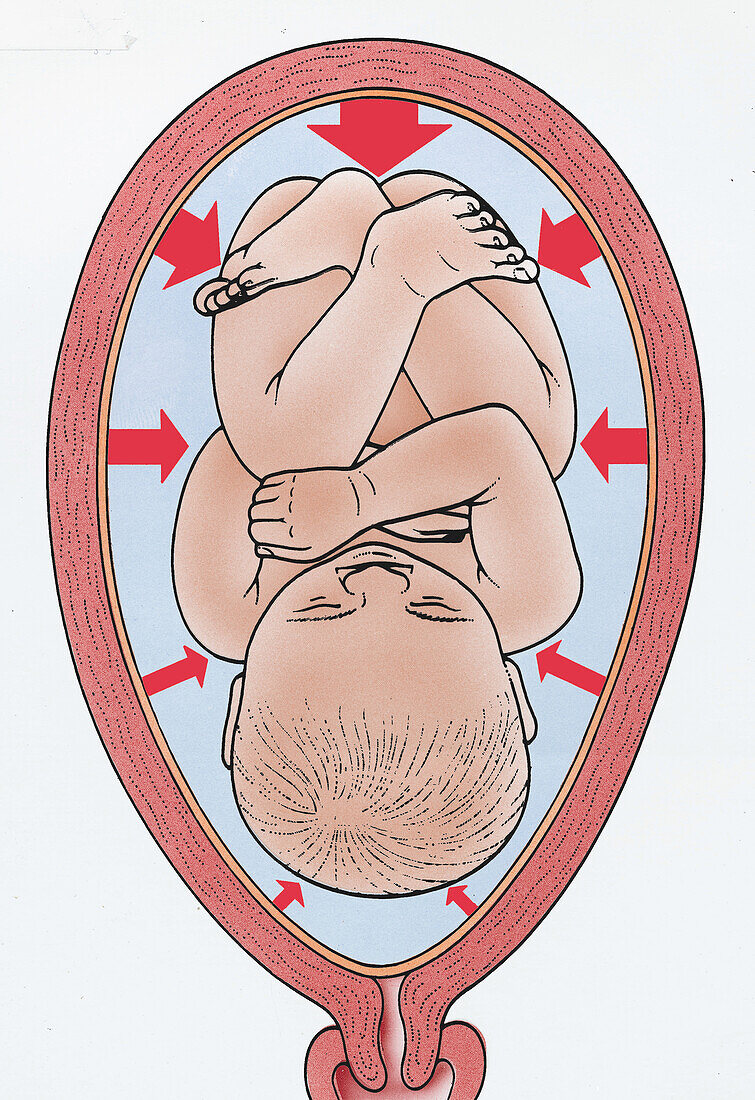 Foetus in a womb, illustration