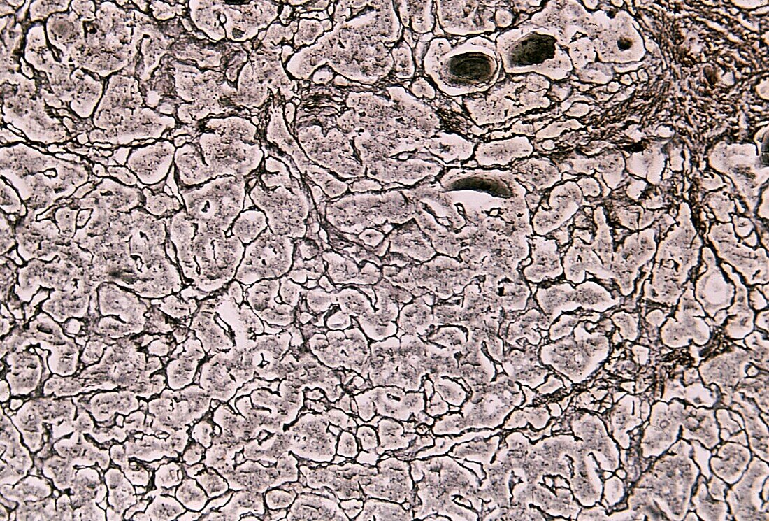 Reticular fibres in human pituitary gland, light micrograph