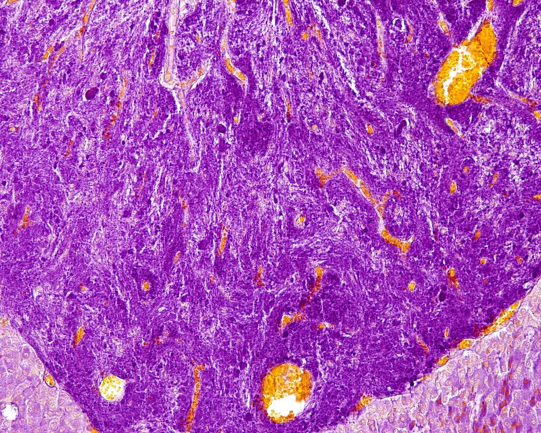 Posterior pituitary gland, light micrograph