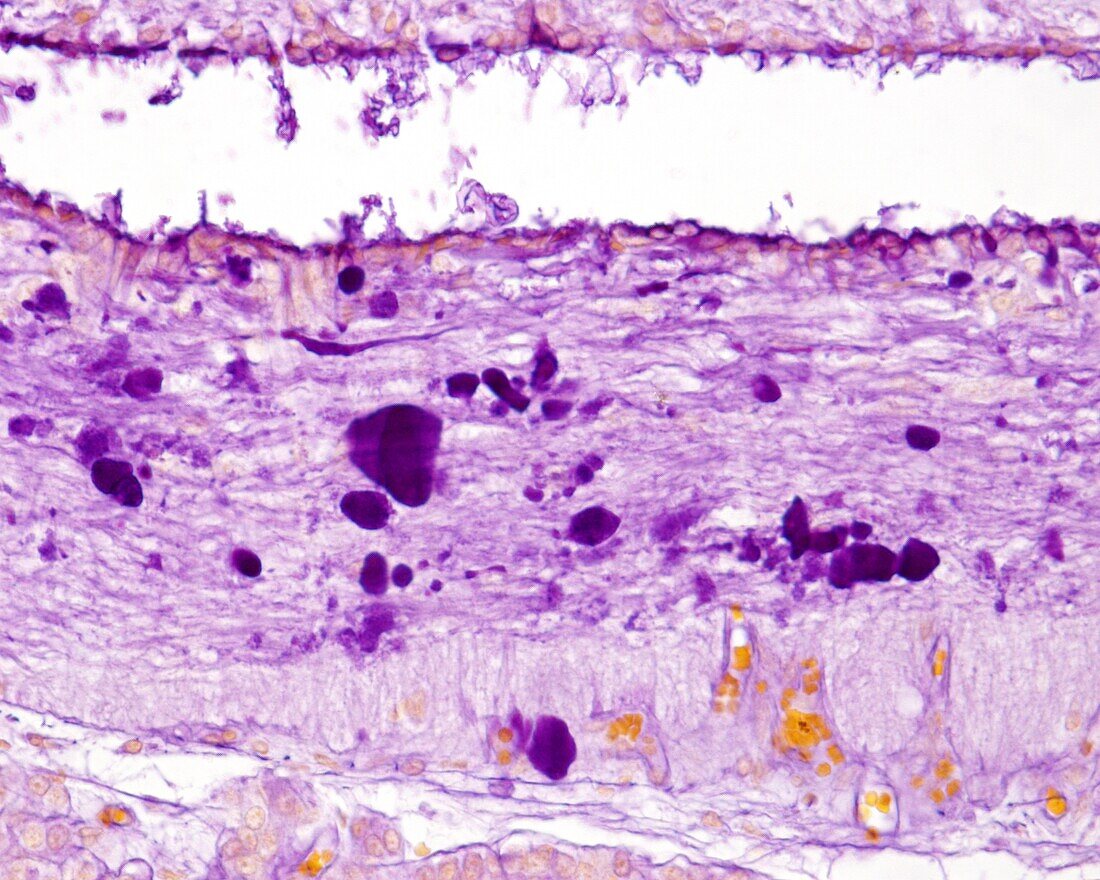 Pituitary gland stalk, light micrograph