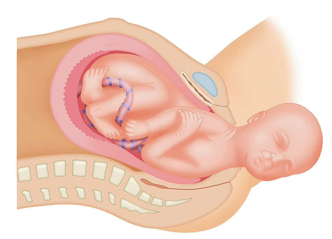 Childbirth, illustration
