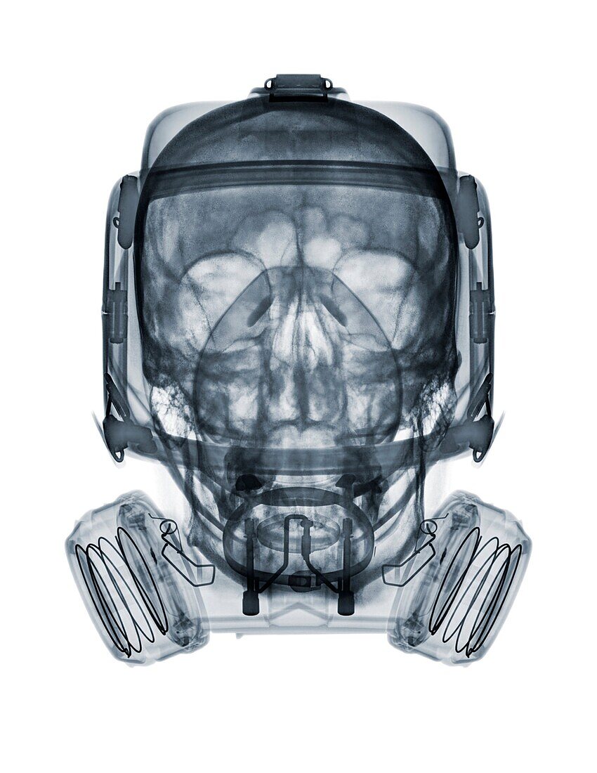 Skull wearing a gasmask, X-ray