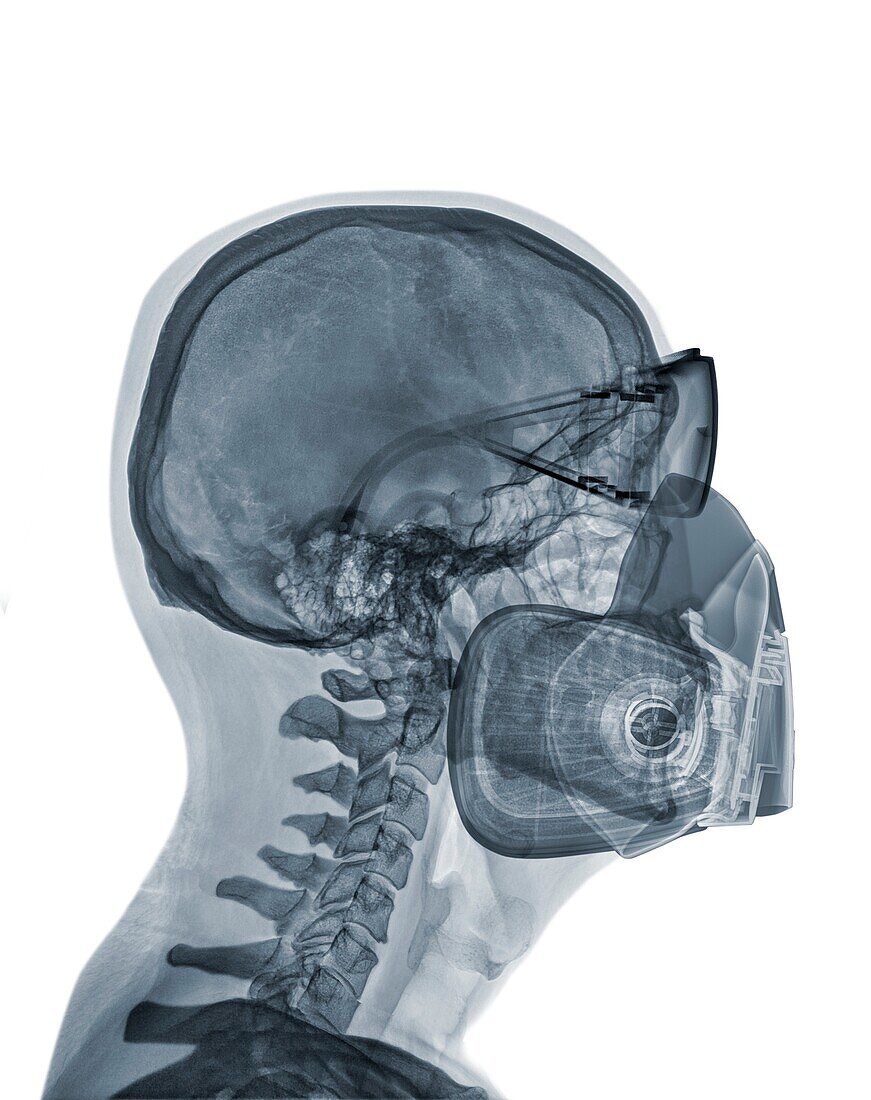 Skull wearing a respirator and glasses, X-ray