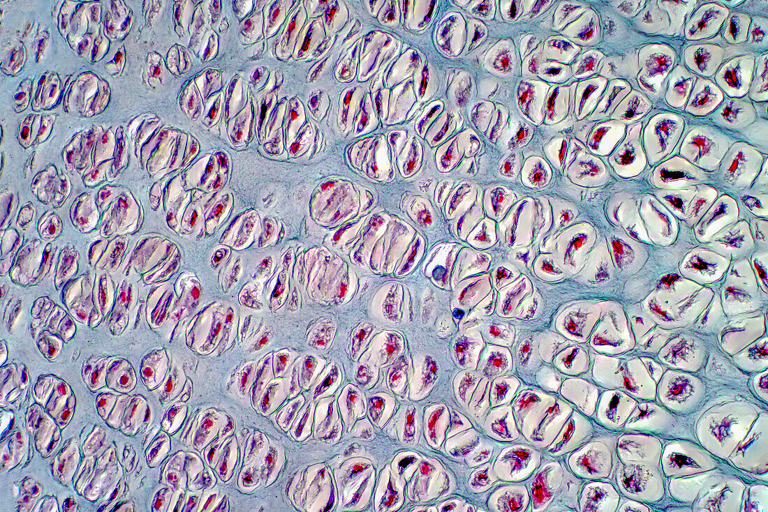 Human cartilage bone, light micrograph