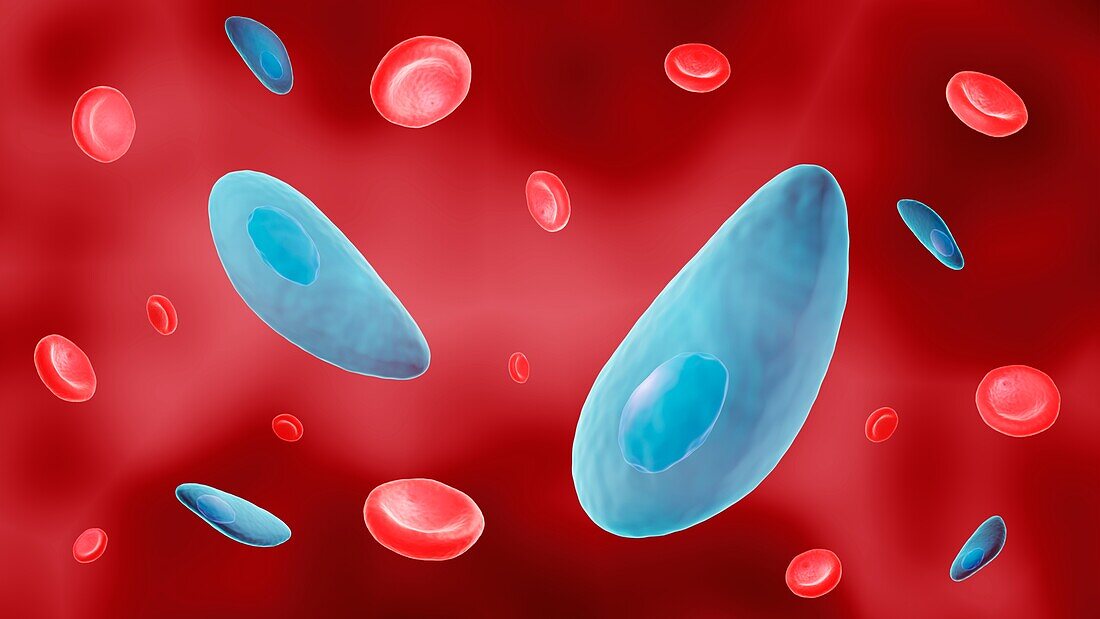 Computer illustration of toxoplasma causing toxoplasmosis