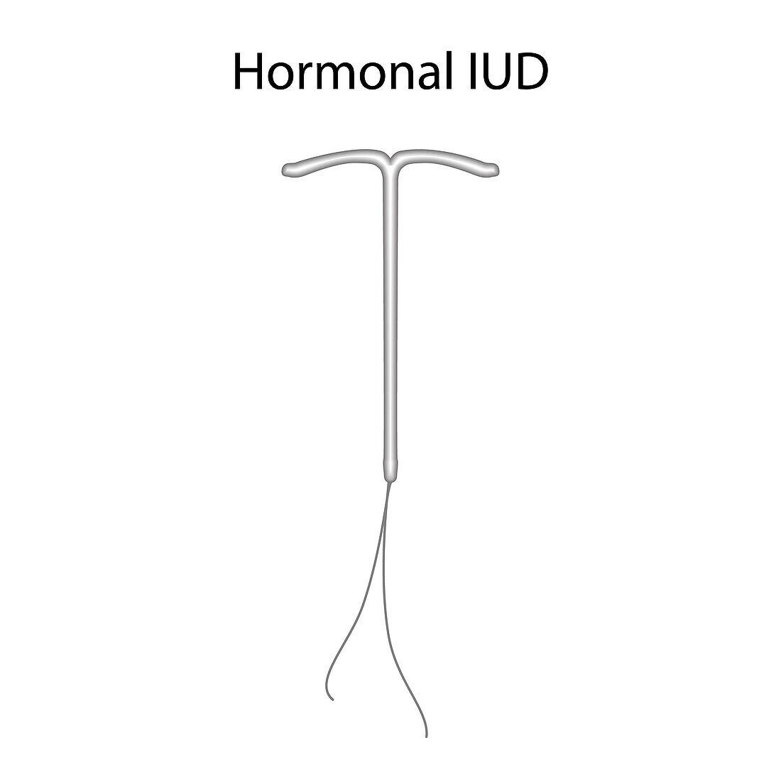 Hormonal intrauterine devices, illustration