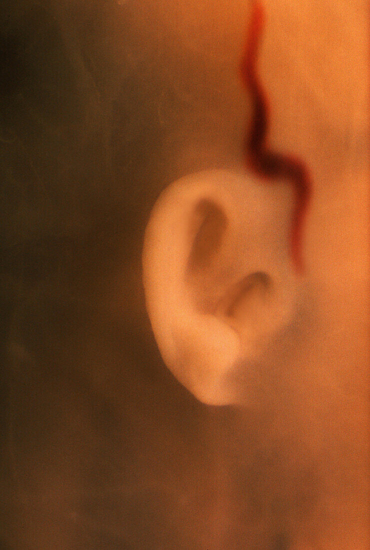 Right Ear of Fetus, 24 Weeks