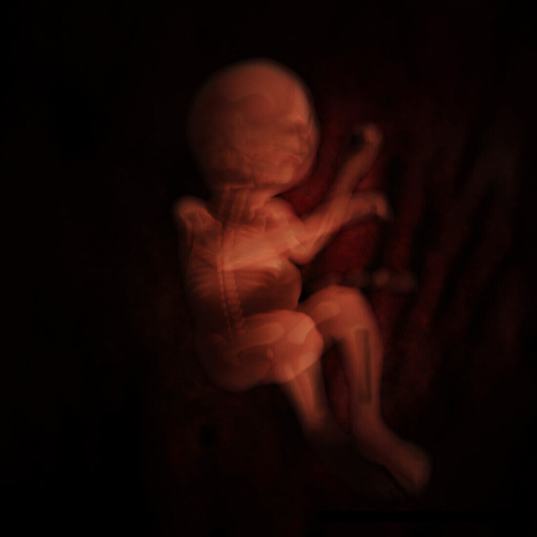 Right-Frontal View of Fetus, 24 Weeks
