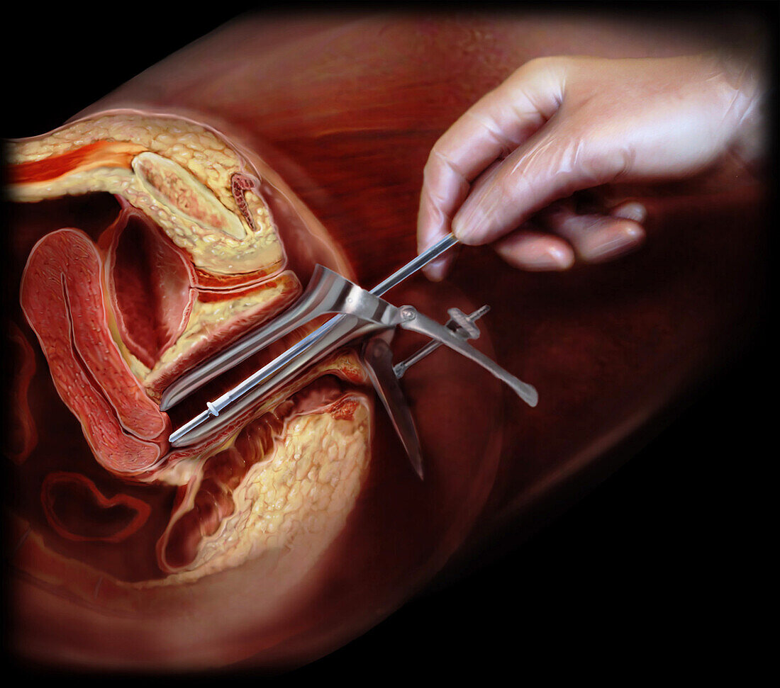 Pap Smear, Female Anatomy