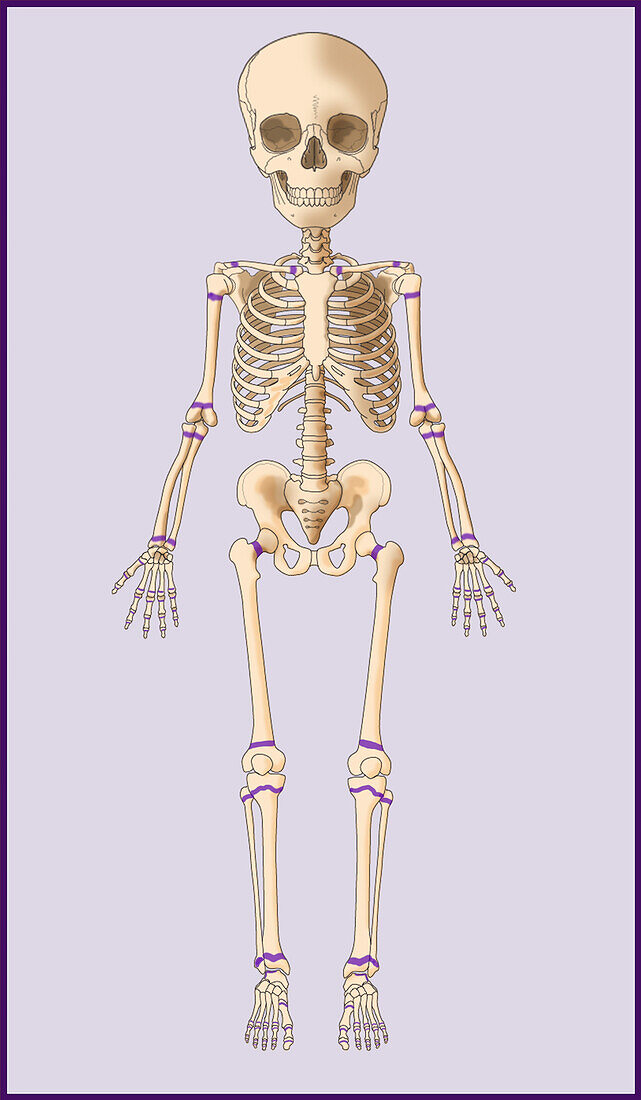 Child's Skeleton, Growth Plates, Illustration