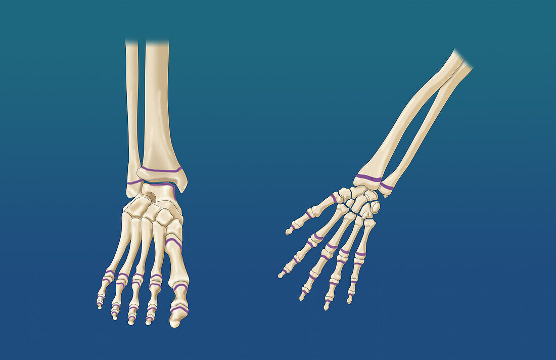 Foot and Hand Growth Plates, Illustration