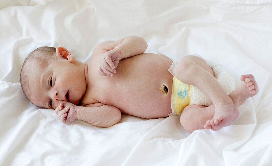 Newborn with Umbilical Cord Stump