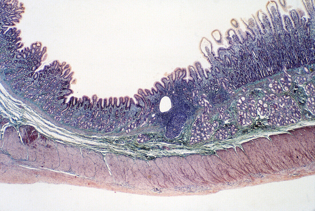 Pyloro-duodenal Junction, LM
