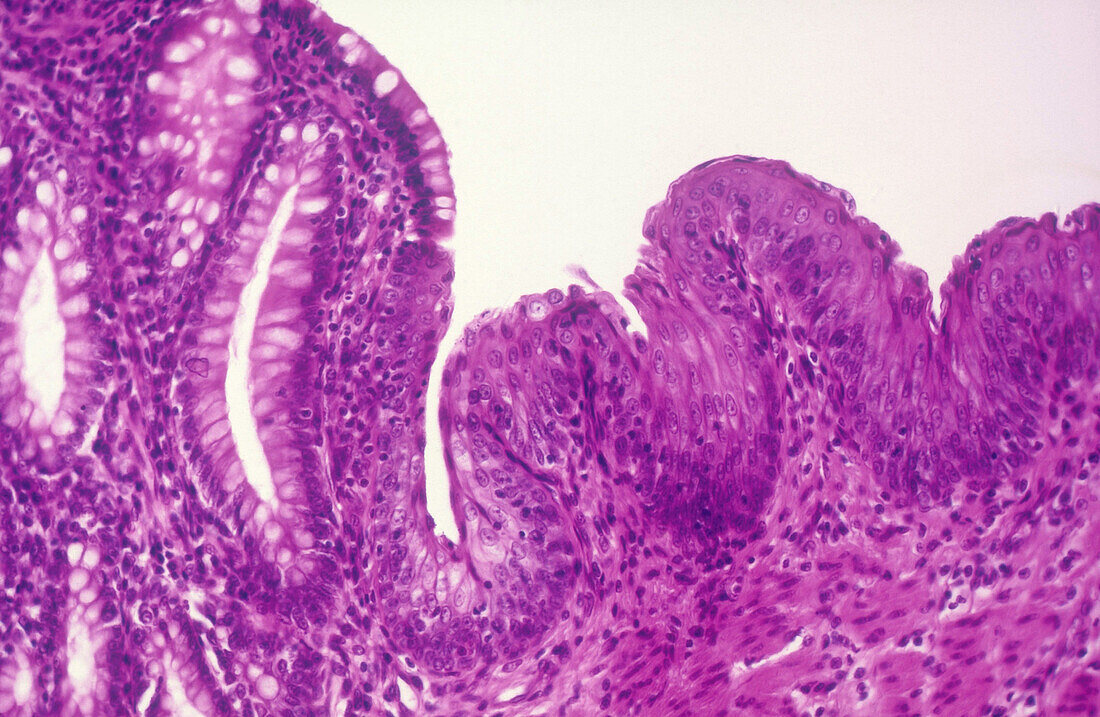 Esophagus, Gastric Glands, LM