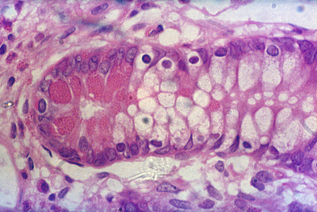 Paneth Cells, Intestinal Crypt, LM