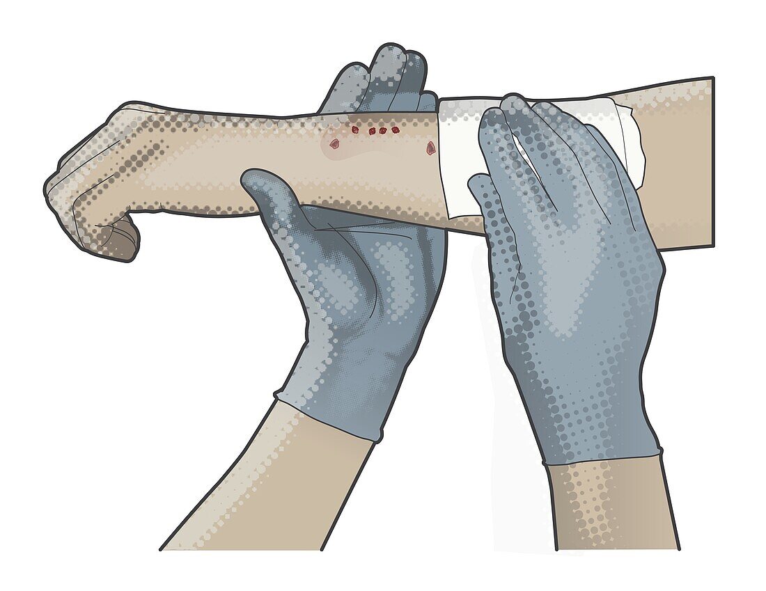 Cleaning injured arm, illustration