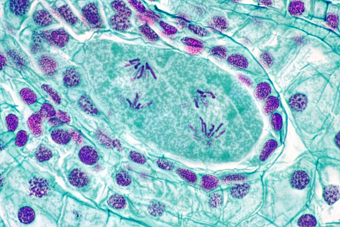 Lilium embryo sac, light micrograph
