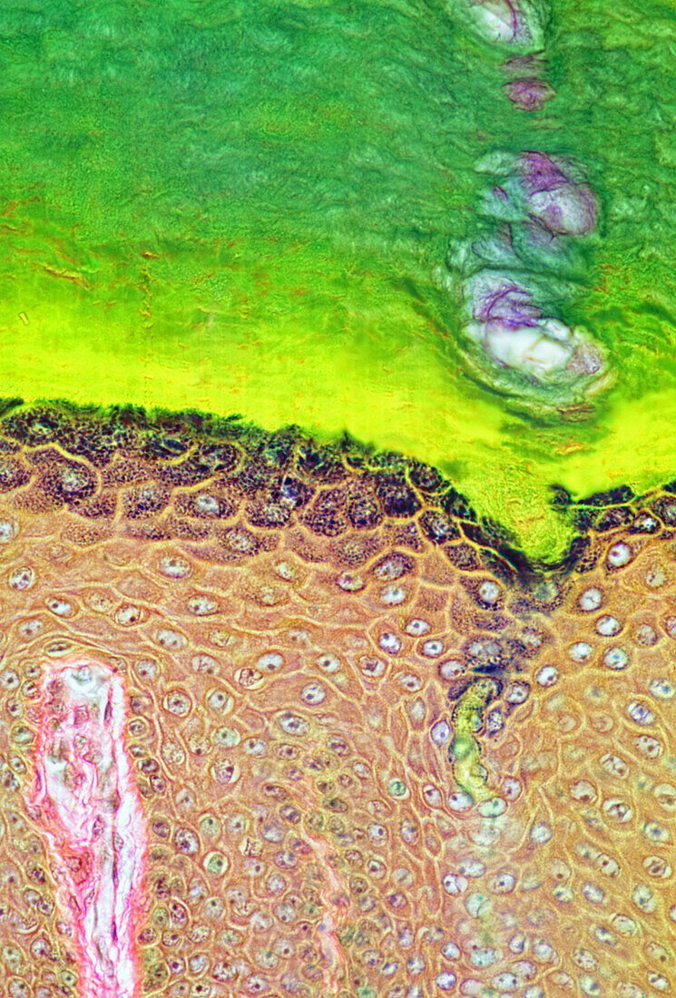 Baboon skin with sweat duct, light micrograph