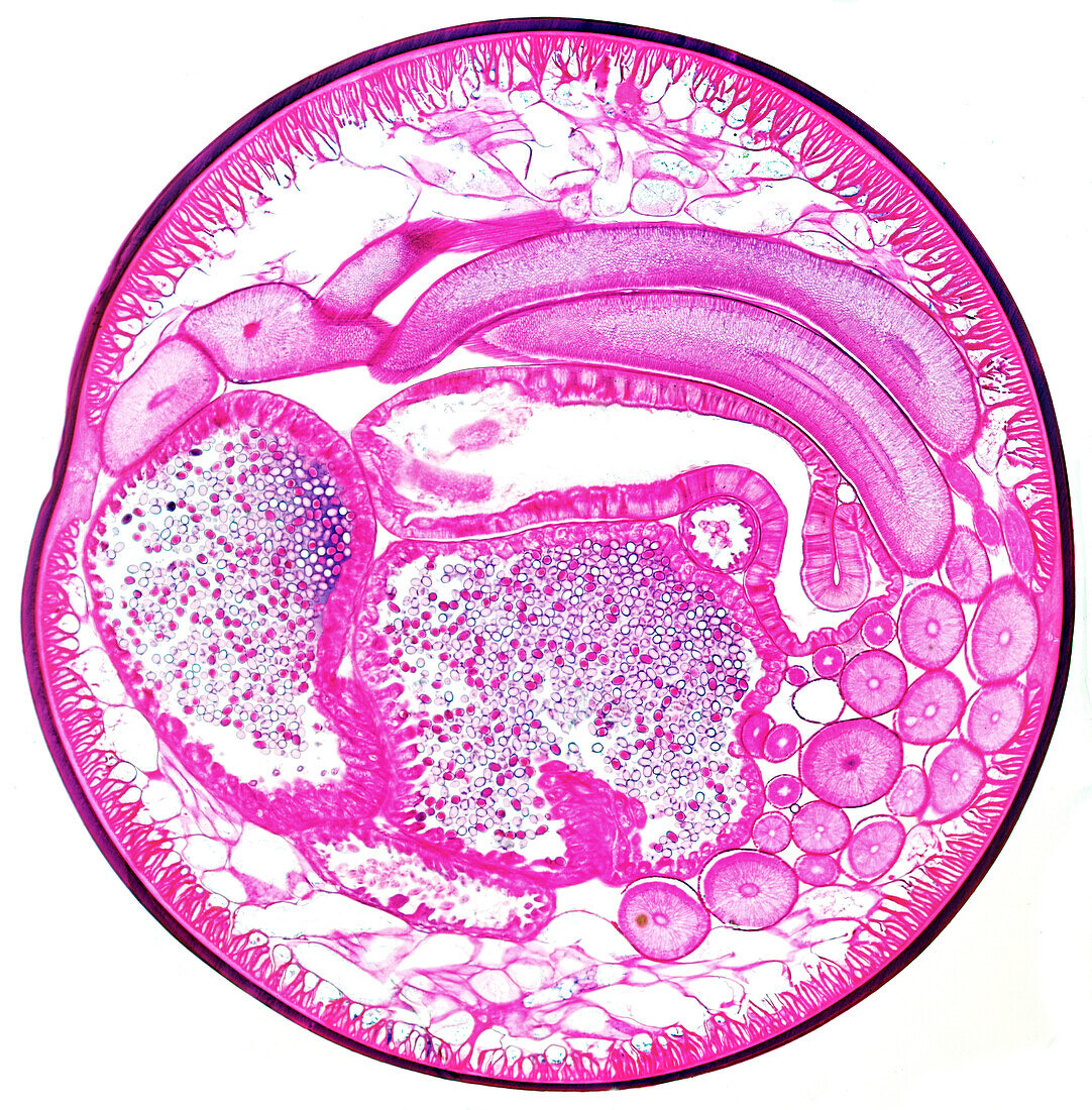 Female roundworm, light micrograph