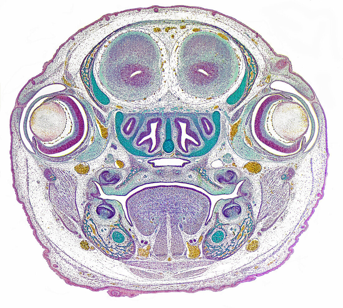 Mouse, fetal head section through eyes, light micrograph