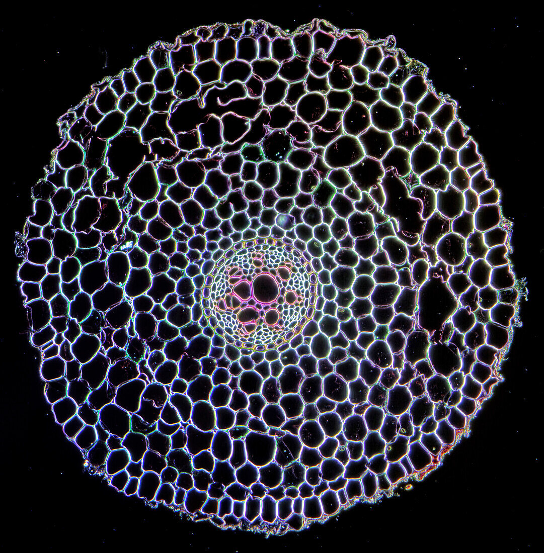 Buttercup root, light micrograph